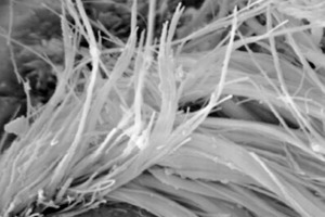  1	Asbestfaser in einer Asbestzementprobe in 5000-facher Ver­größerung, entnommen aus [4] • Asbestos fibre in a sample of asbestos cement magnified 5000 times, taken from [4] 